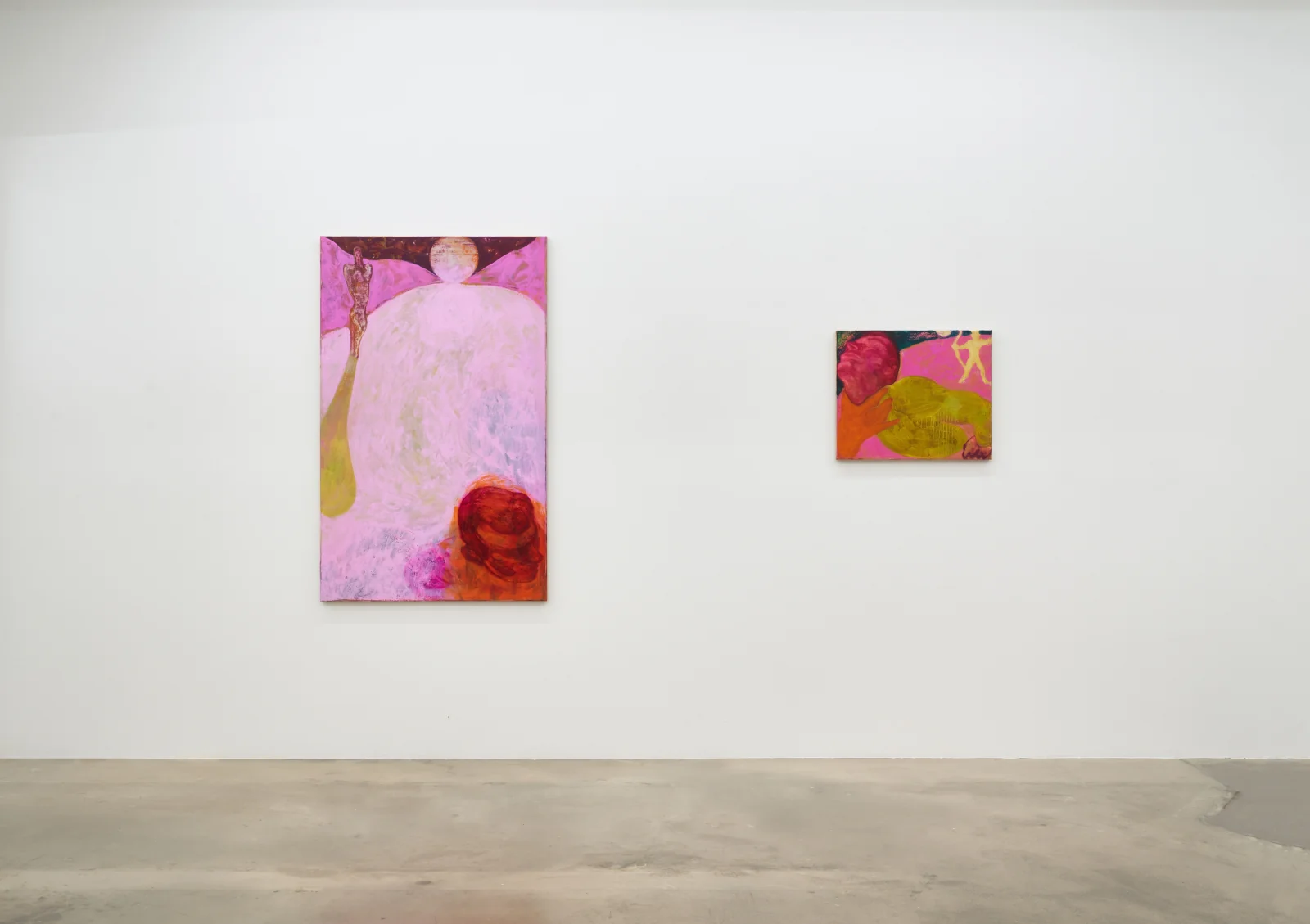 Installation view